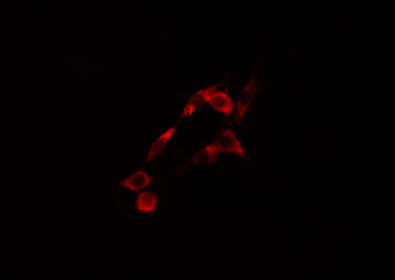 KPI-2 / LMTK2 Antibody - Staining LOVO cells by IF/ICC. The samples were fixed with PFA and permeabilized in 0.1% Triton X-100, then blocked in 10% serum for 45 min at 25°C. The primary antibody was diluted at 1:200 and incubated with the sample for 1 hour at 37°C. An Alexa Fluor 594 conjugated goat anti-rabbit IgG (H+L) antibody, diluted at 1/600, was used as secondary antibody.