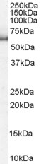 KPNA1 / Importin Alpha 5 Antibody - Antibody staining (1 ug/ml) of HeLa lysate (RIPA buffer, 35 ug total protein per lane). Primary incubated for 1 hour. Detected by Western blot of chemiluminescence.