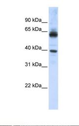 KPNA1 / Importin Alpha 5 Antibody - HepG2 cell lysate. Antibody concentration: 1.0 ug/ml. Gel concentration: 12%.  This image was taken for the unconjugated form of this product. Other forms have not been tested.