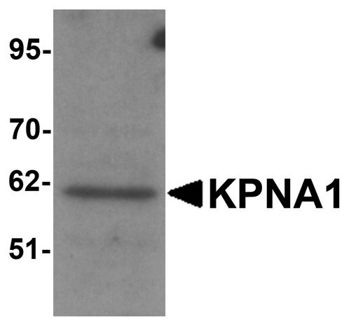 KPNA1 / Importin Alpha 5 Antibody - Western blot analysis of KPNA1 in HeLa cell lysate with KPNA1 antibody at 1ug/ml.