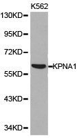 KPNA1 / Importin Alpha 5 Antibody - Western blot of extracts of K562 cell lines, using KPNA1 antibody.