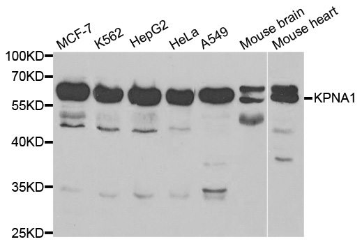 KPNA1 / Importin Alpha 5 Antibody - Western blot analysis of extracts of various cell lines.