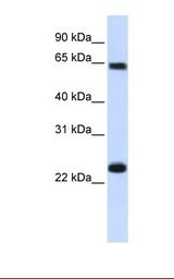 KPNA1 / Importin Alpha 5 Antibody - 721_B cell lysate. Antibody concentration: 1.0 ug/ml. Gel concentration: 12%.  This image was taken for the unconjugated form of this product. Other forms have not been tested.