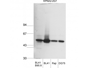 KPNA2 / Importin Alpha 1 Antibody - Western blot of KPNA2 / Importin Alpha 1 antibody.