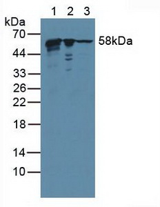 KPNA2 / Importin Alpha 1 Antibody - Western Blot; Lane1: Human HepG2 Cells; Lane2: Human 293T Cells; Lane3: Human Raji Cells.