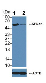 KPNA2 / Importin Alpha 1 Antibody - Knockout Varification: Lane 1: Wild-type HepG2 cell lysate; Lane 2: KPNa2 knockout HepG2 cell lysate; Predicted MW: 58kDa ; Observed MW: 58kDa; Primary Ab: 3µg/ml Rabbit Anti-Human KPNa2 Antibody; Second Ab: 0.2µg/mL HRP-Linked Caprine Anti-Rabbit IgG Polyclonal Antibody;