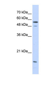 KPNA2 / Importin Alpha 1 Antibody - KPNA2 antibody Western blot of Transfected 293T cell lysate. This image was taken for the unconjugated form of this product. Other forms have not been tested.