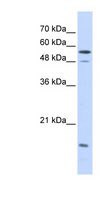KPNA2 / Importin Alpha 1 Antibody - KPNA2 antibody Western blot of Transfected 293T cell lysate. This image was taken for the unconjugated form of this product. Other forms have not been tested.