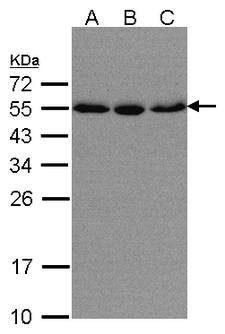 KPNA2 / Importin Alpha 1 Antibody - Sample (30 ug of whole cell lysate). A: HeLa S3, B: Hep G2, C: MOLT4. 10% SDS PAGE. KPNA2 / Importin Alpha 1 antibody diluted at 1:500