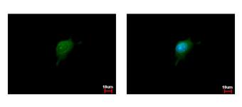KPNA2 / Importin Alpha 1 Antibody - karyopherin alpha 2 antibody [C3], C-term detects karyopherin alpha 2 protein at cytoplasm and nucleus by immunofluorescent analysis. HeLa cells were fixed in ice-cold MeOH for 5 min. karyopherin alpha 2 protein stained by karyopherin alpha 2 antibody [C3], C-term diluted at 1:500. 
