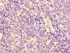 KPNA2 / Importin Alpha 1 Antibody - Immunohistochemistry of paraffin-embedded human lymph node tissue using KPNA2 Antibody at dilution of 1:100