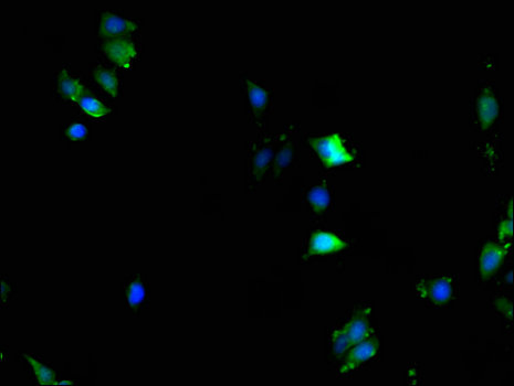 KPNA2 / Importin Alpha 1 Antibody - Immunofluorescent analysis of HepG2 cells using KPNA2 Antibody at a dilution of 1:100 and Alexa Fluor 488-congugated AffiniPure Goat Anti-Rabbit IgG(H+L)
