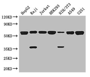 KPNA2 / Importin Alpha 1 Antibody - Positive WB detected in:HepG2 whole cell lysate,Raji whole cell lysate,Jurkat whole cell lysate,HEK293 whole cell lysate,NIH/3T3 whole cell lysate,A549 whole cell lysate,U251 whole cell lysate;All lanes: KPNA2 antibody at 3ug/ml;Secondary;Goat polyclonal to rabbit IgG at 1/50000 dilution;Predicted band size: 58 kDa;Observed band size: 58,36 kDa;
