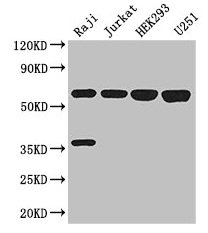 KPNA2 / Importin Alpha 1 Antibody - Western Blot Positive WB detected in: Raji whole cell lysate, Jurkat whole cell lysate, HEK293 whole cell lysate, U251 whole cell lysate All lanes: KPNA2 antibody at 3µg/ml Secondary Goat polyclonal to rabbit IgG at 1/50000 dilution Predicted band size: 58 kDa Observed band size: 58 kDa