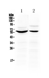 KPNA2 / Importin Alpha 1 Antibody - Western blot analysis of KPNA2 using anti-KPNA2 antibody. Electrophoresis was performed on a 5-20% SDS-PAGE gel at 70V (Stacking gel) / 90V (Resolving gel) for 2-3 hours. The sample well of each lane was loaded with 50ug of sample under reducing conditions. Lane 1: human Hela whole cell lysate,Lane 2: human HepG2 whole cell lysate. After Electrophoresis, proteins were transferred to a Nitrocellulose membrane at 150mA for 50-90 minutes. Blocked the membrane with 5% Non-fat Milk/ TBS for 1.5 hour at RT. The membrane was incubated with rabbit anti-KPNA2 antigen affinity purified polyclonal antibody at 0.5 µg/mL overnight at 4°C, then washed with TBS-0.1% Tween 3 times with 5 minutes each and probed with a goat anti-rabbit IgG-HRP secondary antibody at a dilution of 1:10000 for 1.5 hour at RT. The signal is developed using an Enhanced Chemiluminescent detection (ECL) kit with Tanon 5200 system. A specific band was detected for KPNA2 at approximately 58KD. The expected band size for KPNA2 is at 58KD.