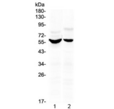KPNA2 / Importin Alpha 1 Antibody - Western blot testing of human 1) HeLa and 2) HepG2 cell lysate with KPNA2 antibody at 0.5ug/ml. Predicted molecular weight: ~58 kDa.