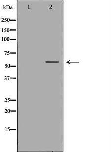 KPNA2 / Importin Alpha 1 Antibody - Western blot analysis of HeLa whole cell lysates using KPNA2 antibody. The lane on the left is treated with the antigen-specific peptide.