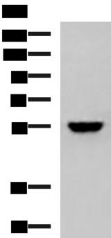 KPNA2 / Importin Alpha 1 Antibody - Western blot analysis of 293T cell lysate  using KPNA2 Polyclonal Antibody at dilution of 1:1000
