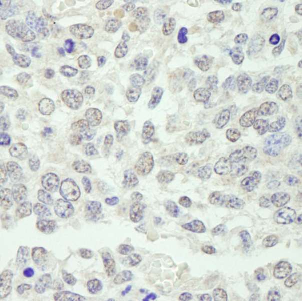 KPNA3 / Importin Alpha 4 Antibody - Detection of Mouse KPNA3 by Immunohistochemistry. Sample: FFPE section of mouse teratoma. Antibody: Affinity purified rabbit anti-KPNA3 used at a dilution of 1:250.