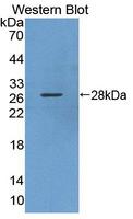 KPNA3 / Importin Alpha 4 Antibody - Western blot of KPNA3 / Importin Alpha 4 antibody.