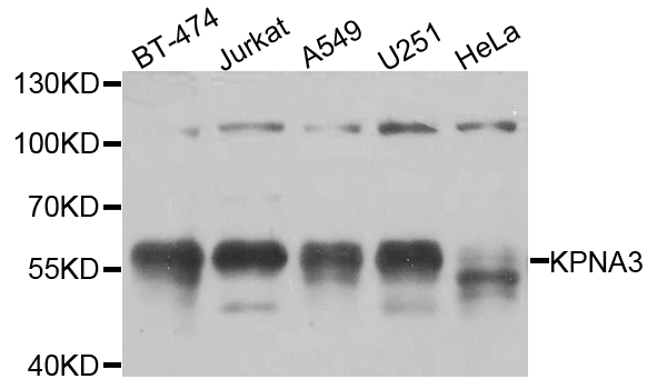KPNA3 / Importin Alpha 4 Antibody - Western blot analysis of extracts of various cell lines.