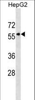 KPNA5 Antibody - KPNA5 Antibody western blot of HepG2 cell line lysates (35 ug/lane). The KPNA5 antibody detected the KPNA5 protein (arrow).