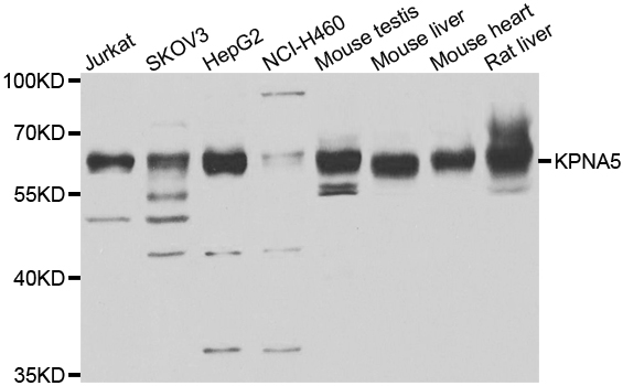 KPNA5 Antibody - Western blot analysis of extracts of various cell lines.