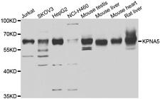 KPNA5 Antibody - Western blot analysis of extracts of various cell lines.