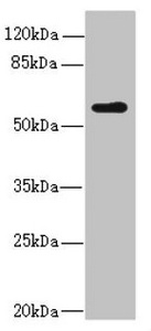 KPNA5 Antibody - Western blot All Lanes:KPNA5 antibody at 2.04ug/ml +Mouse liver tissue Goat polyclonal to rabbit at 1/10000 dilution Predicted band size: 60 kDa Observed band size: 60 kDa