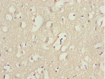 KPNA5 Antibody - Immunohistochemistry of paraffin-embedded human brain tissue at dilution 1:100