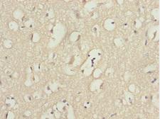 KPNA5 Antibody - Immunohistochemistry of paraffin-embedded human brain tissue at dilution 1:100