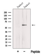 KPNA5 Antibody - Western blot analysis of extracts of 3T3 cells using KPNA5 antibody. The lane on the left was treated with blocking peptide.