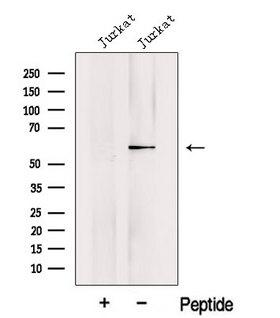 KPNA5 Antibody - Western blot analysis of extracts of 3T3 cells using KPNA5 antibody. The lane on the left was treated with blocking peptide.