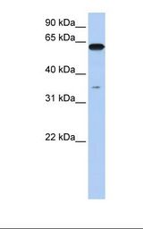 KPNA6 Antibody - Fetal brain lysate. Antibody concentration: 1.0 ug/ml. Gel concentration: 12%.  This image was taken for the unconjugated form of this product. Other forms have not been tested.