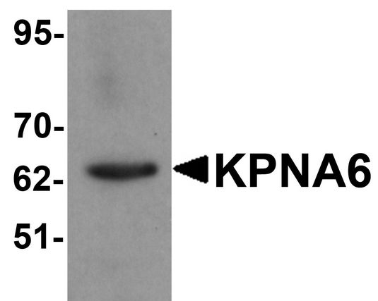KPNA6 Antibody - Western blot analysis of KPNA6 in 293 cell lysate with KPNA6 antibody at 1 ug/ml.
