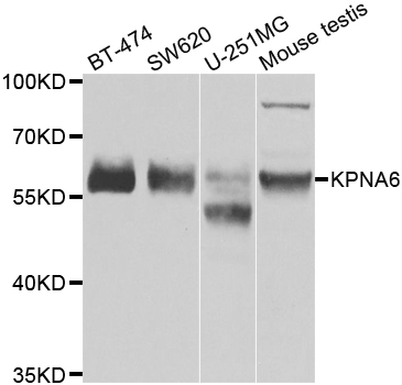 KPNA6 Antibody - Western blot analysis of extracts of various cell lines.