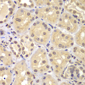 KPNA6 Antibody - Immunohistochemistry of paraffin-embedded human kidney tissue.