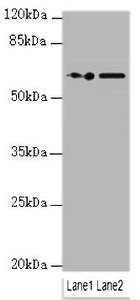KPNA6 Antibody - Western blot All Lanes:KPNA6 antibody at 0.95ug/ml Lane 1 : PC-3 whole cell lysate Lane 2 : Hela whole cell lysate Secondary Goat polyclonal to Rabbit IgG at 1/10000 dilution Predicted band size: 60 kDa Observed band size: 60 kDa