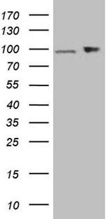 KPNB1 / Importin Beta Antibody - HEK293T cells were transfected with the pCMV6-ENTRY control. (Left lane) or pCMV6-ENTRY KPNB1. (Right lane) cDNA for 48 hrs and lysed. Equivalent amounts of cell lysates. (5 ug per lane) were separated by SDS-PAGE and immunoblotted with anti-KPNB1. (1:2000)