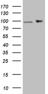KPNB1 / Importin Beta Antibody - HEK293T cells were transfected with the pCMV6-ENTRY control. (Left lane) or pCMV6-ENTRY KPNB1. (Right lane) cDNA for 48 hrs and lysed. Equivalent amounts of cell lysates. (5 ug per lane) were separated by SDS-PAGE and immunoblotted with anti-KPNB1. (1:2000)