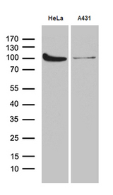 KPNB1 / Importin Beta Antibody - Western blot analysis of extracts. (35ug) from 2 different cell lines by using anti-KPNB1 monoclonal antibody. (1:500)