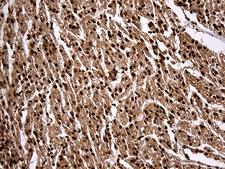 KPNB1 / Importin Beta Antibody - Immunohistochemical staining of paraffin-embedded Human adult heart tissue within the normal limits using anti-KPNB1 mouse monoclonal antibody. (Heat-induced epitope retrieval by 1mM EDTA in 10mM Tris buffer. (pH8.5) at 120 oC for 3 min. (1:2000)