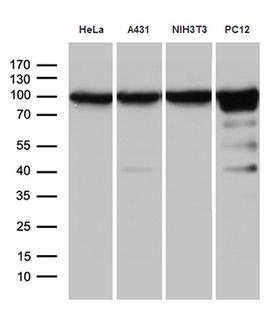 KPNB1 / Importin Beta Antibody - Western blot analysis of extracts. (35ug) from 4 different cell lines by using anti-KPNB1 monoclonal antibody. (1:500)
