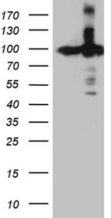 KPNB1 / Importin Beta Antibody - HEK293T cells were transfected with the pCMV6-ENTRY control. (Left lane) or pCMV6-ENTRY KPNB1. (Right lane) cDNA for 48 hrs and lysed