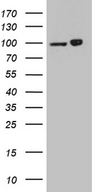 KPNB1 / Importin Beta Antibody - HEK293T cells were transfected with the pCMV6-ENTRY control. (Left lane) or pCMV6-ENTRY KPNB1. (Right lane) cDNA for 48 hrs and lysed. Equivalent amounts of cell lysates. (5 ug per lane) were separated by SDS-PAGE and immunoblotted with anti-KPNB1. (1:2000)