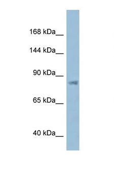 KPNB1 / Importin Beta Antibody - KPNB1 antibody Western blot of ACHN Cell lysate. Antibody concentration 1 ug/ml.  This image was taken for the unconjugated form of this product. Other forms have not been tested.