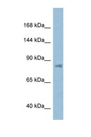 KPNB1 / Importin Beta Antibody - KPNB1 antibody Western blot of ACHN Cell lysate. Antibody concentration 1 ug/ml.  This image was taken for the unconjugated form of this product. Other forms have not been tested.