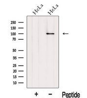 KPNB1 / Importin Beta Antibody - Western blot analysis of extracts of HeLa cells using Importinbeta antibody. The lane on the left was treated with blocking peptide.