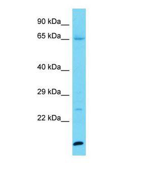 KPRP Antibody - Western blot of KPRP Antibody - C-terminal region with human Jurkat cells lysate.  This image was taken for the unconjugated form of this product. Other forms have not been tested.