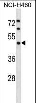 KPTN / Kaptin Antibody - KPTN Antibody western blot of NCI-H460 cell line lysates (35 ug/lane). The KPTN antibody detected the KPTN protein (arrow).